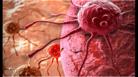 癌细胞爱吃什么？人类能通过“饿死”癌细胞来击破癌症吗？