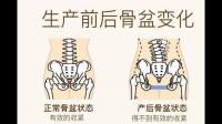 产后到底有没有必要做骨盆修复？