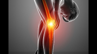 膝盖经常痛，是因为胖（100kg），还是运动剧烈?