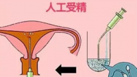 多地拟将辅助生殖项目纳入医保报销范围，这透