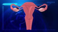 子宫肌瘤是怎么形成的？会对身体产生哪些影响？