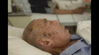 癌症患者如何能面对生死，作为家属又该有怎样的心里建设？