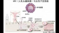 男性hpv是怎么感染上的?