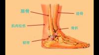 踝关节扭伤怎么恢复？