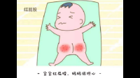 如何正确挑选婴儿护臀膏？